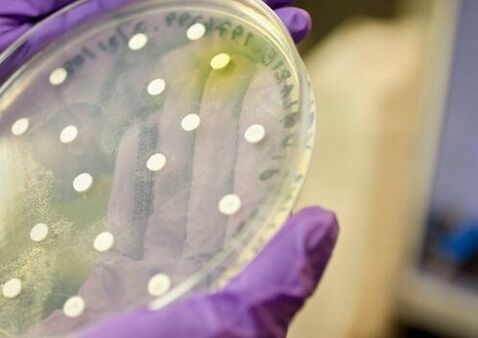 bacterial culture for diagnosis of prostatitis